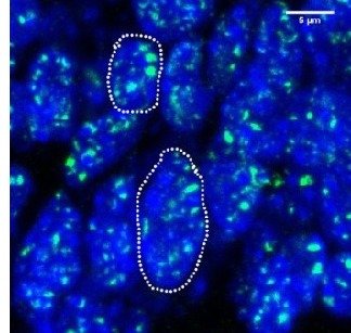 0984602001529685019_1