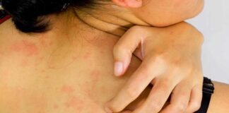 Η Αφρικανική Σκόνη μεταφέρει δηλητηριώδεις ουσίες που είναι επικίνδυνες για την Υγεία μας αλλά και μπορεί να ερεθίσει το δέρμα, προκαλώντας ξηρότητα, εξανθήματα και κνησμό.