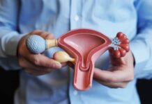 Προστατεκτομή TURis: Τι είναι και πως αντιμετωπίζεται;